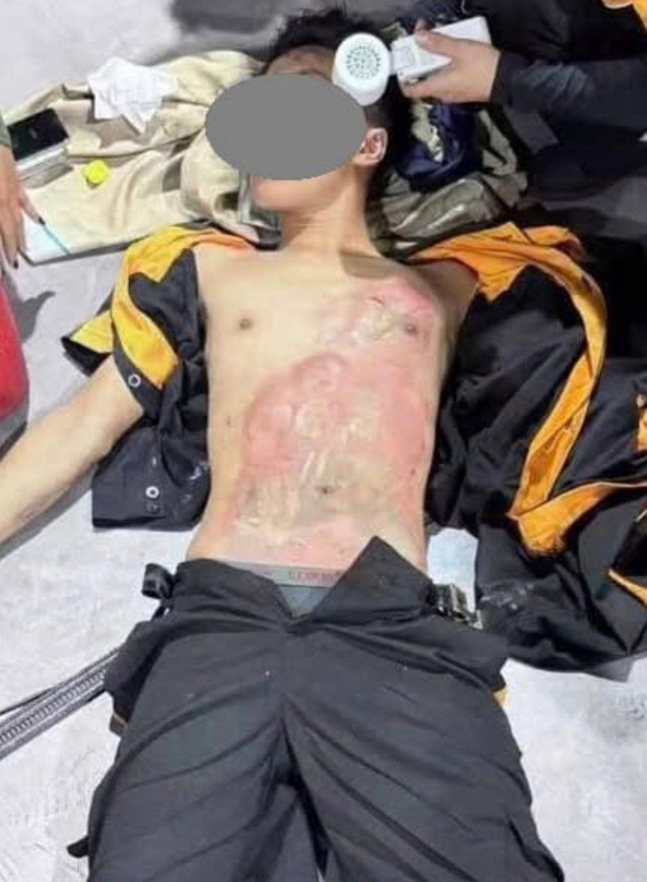 Nhấn để xem chi tiết